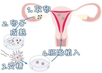 关于暖阳生殖